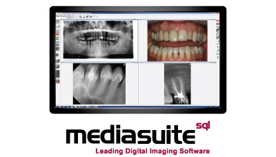 mediasuite-product-image